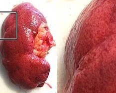 kidney 6 1