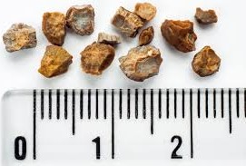 stone1